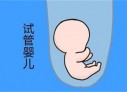 培养长春捐卵宝宝艺术细胞的小技巧